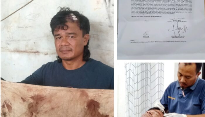 Kepala Sobek 14 Jahitan, Petani Inhu Diduga Dianiaya Preman Bayaran PT SBP