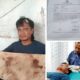 Kepala Sobek 14 Jahitan, Petani Inhu Diduga Dianiaya Preman Bayaran PT SBP